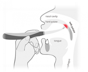 Goodsomnia review snoring device